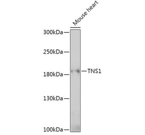 Western Blot - Anti-Tensin 1 Antibody (A307886) - Antibodies.com