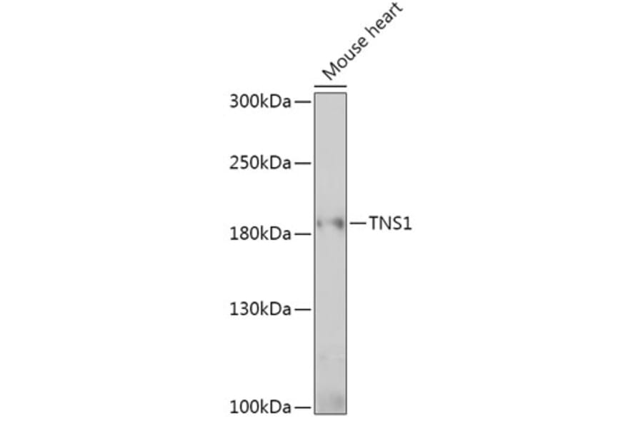Western Blot - Anti-Tensin 1 Antibody (A307886) - Antibodies.com