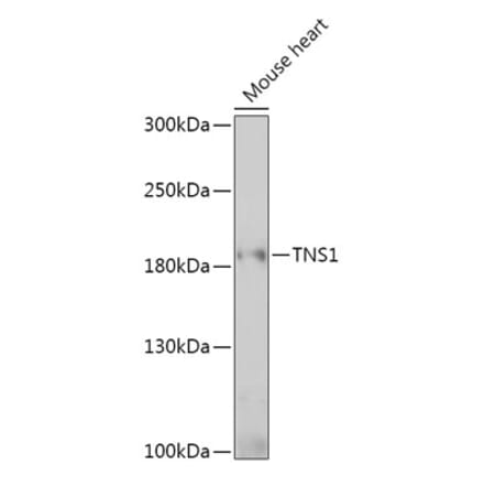Western Blot - Anti-Tensin 1 Antibody (A307886) - Antibodies.com
