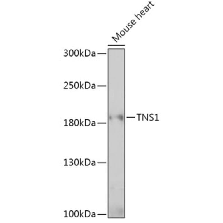 Western Blot - Anti-Tensin 1 Antibody (A307886) - Antibodies.com