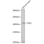 Western Blot - Anti-Tensin 1 Antibody (A307886) - Antibodies.com