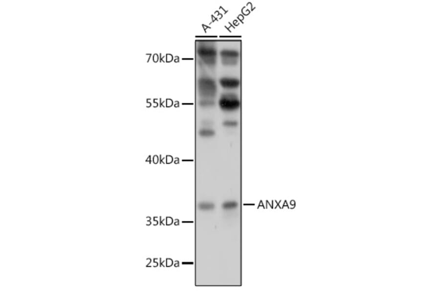 Western Blot - Anti-Annexin-9/ANXA9 Antibody (A307887) - Antibodies.com