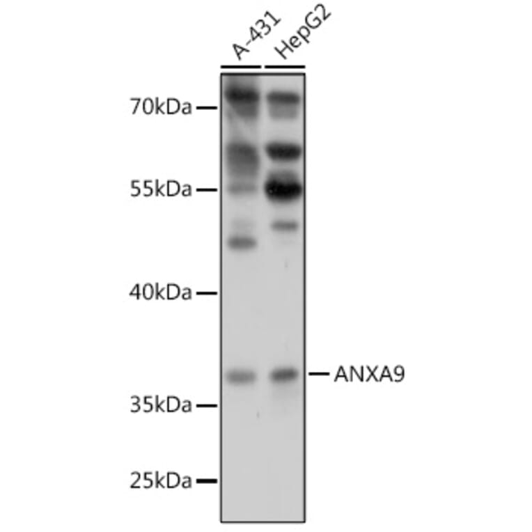 Western Blot - Anti-Annexin-9/ANXA9 Antibody (A307887) - Antibodies.com