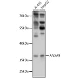 Western Blot - Anti-Annexin-9/ANXA9 Antibody (A307887) - Antibodies.com
