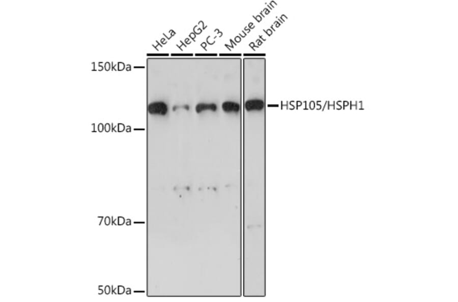 Western Blot - Anti-Hsp105/HSP110 Antibody (A307888) - Antibodies.com