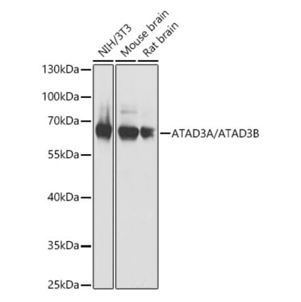 Western Blot - Anti-ATAD3B Antibody (A307889) - Antibodies.com