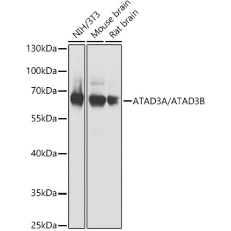 Western Blot - Anti-ATAD3B Antibody (A307889) - Antibodies.com