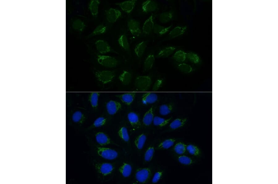 Immunofluorescence - Anti-ATAD3B Antibody (A307889) - Antibodies.com