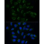 Immunofluorescence - Anti-ATAD3B Antibody (A307889) - Antibodies.com