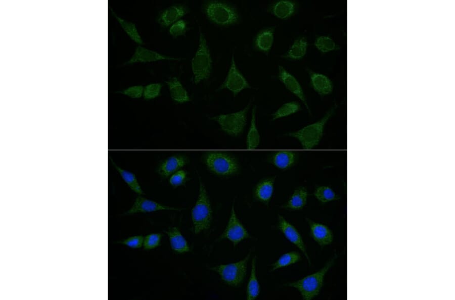 Immunofluorescence - Anti-ATAD3B Antibody (A307889) - Antibodies.com