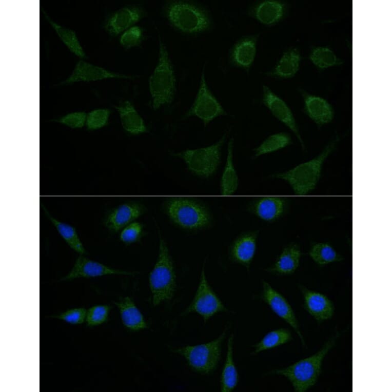 Immunofluorescence - Anti-ATAD3B Antibody (A307889) - Antibodies.com