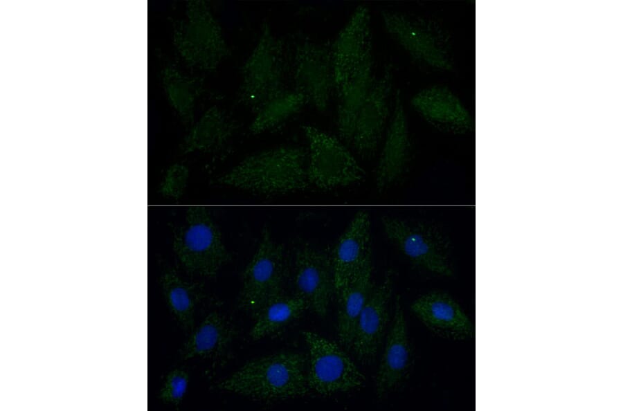 Immunofluorescence - Anti-ATAD3B Antibody (A307889) - Antibodies.com