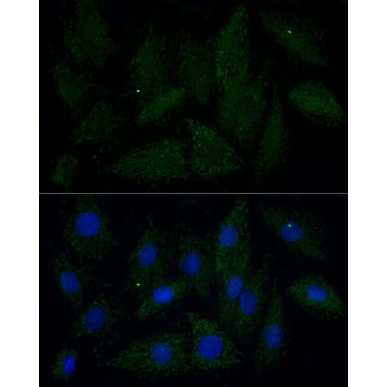 Immunofluorescence - Anti-ATAD3B Antibody (A307889) - Antibodies.com