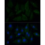 Immunofluorescence - Anti-ATAD3B Antibody (A307889) - Antibodies.com