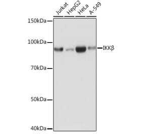 Western Blot - Anti-IKK beta Antibody [ARC0085] (A307890) - Antibodies.com