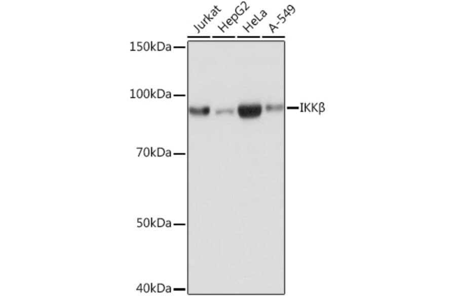 Western Blot - Anti-IKK beta Antibody [ARC0085] (A307890) - Antibodies.com