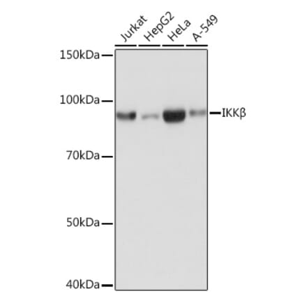 Western Blot - Anti-IKK beta Antibody [ARC0085] (A307890) - Antibodies.com