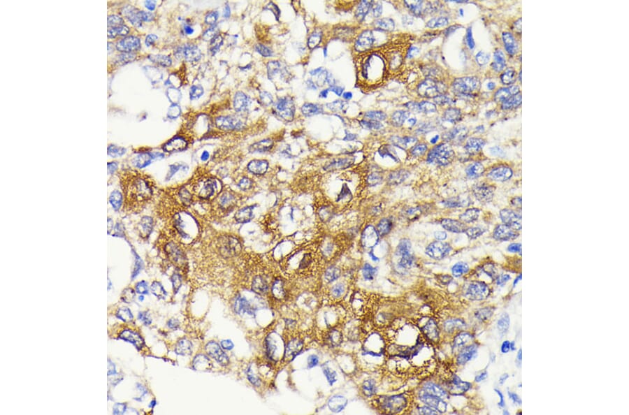 Immunohistochemistry - Anti-IKK beta Antibody [ARC0085] (A307890) - Antibodies.com