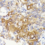 Immunohistochemistry - Anti-IKK beta Antibody [ARC0085] (A307890) - Antibodies.com