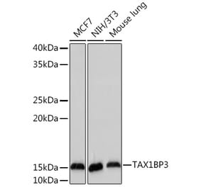 Western Blot - Anti-TIP-1 Antibody [ARC2319] (A307891) - Antibodies.com