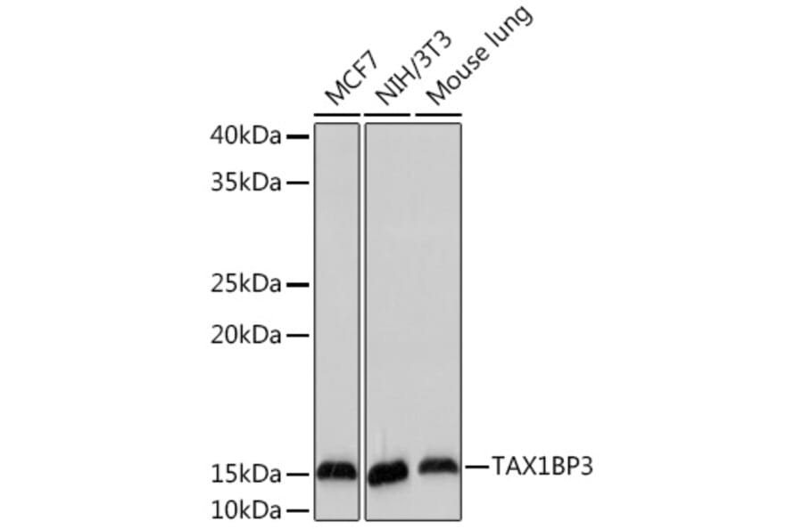 Western Blot - Anti-TIP-1 Antibody [ARC2319] (A307891) - Antibodies.com