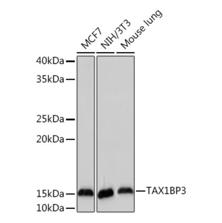 Western Blot - Anti-TIP-1 Antibody [ARC2319] (A307891) - Antibodies.com