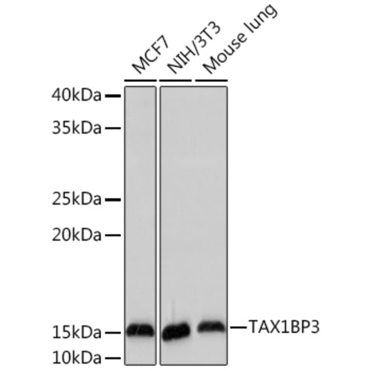 Western Blot - Anti-TIP-1 Antibody [ARC2319] (A307891) - Antibodies.com