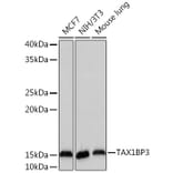 Western Blot - Anti-TIP-1 Antibody [ARC2319] (A307891) - Antibodies.com