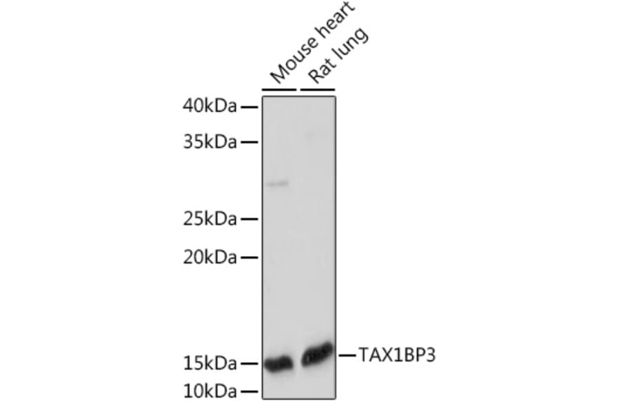 Western Blot - Anti-TIP-1 Antibody [ARC2319] (A307891) - Antibodies.com