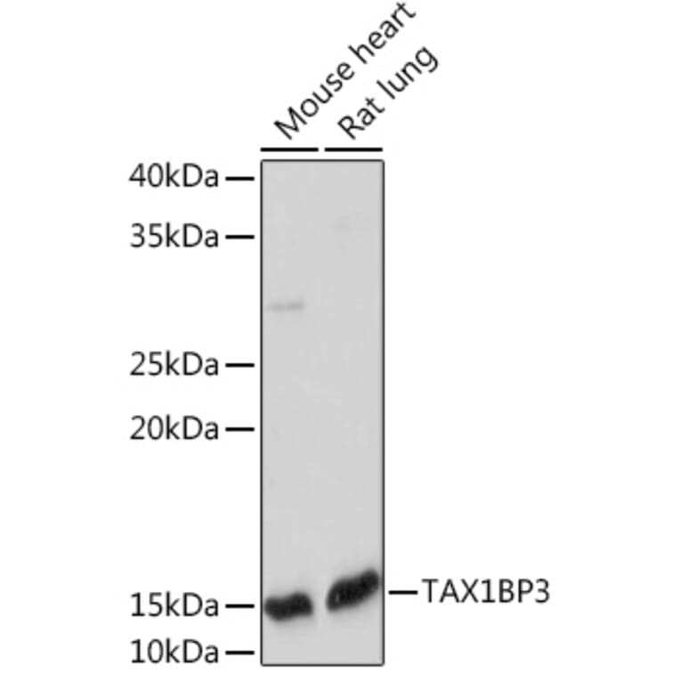 Western Blot - Anti-TIP-1 Antibody [ARC2319] (A307891) - Antibodies.com