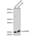 Western Blot - Anti-TIP-1 Antibody [ARC2319] (A307891) - Antibodies.com