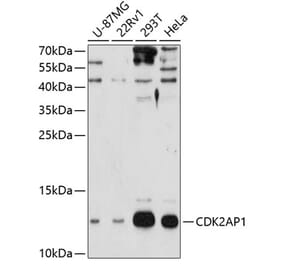 Western Blot - Anti-CDKA1 / DOC1 Antibody (A307893) - Antibodies.com