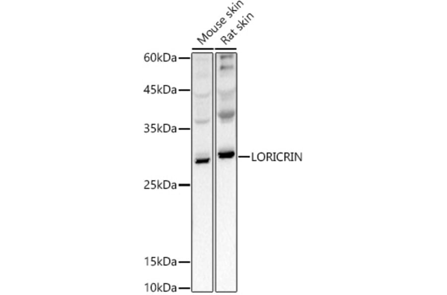 Western Blot - Anti-Loricrin Antibody (A307894) - Antibodies.com