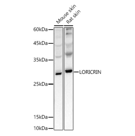 Western Blot - Anti-Loricrin Antibody (A307894) - Antibodies.com