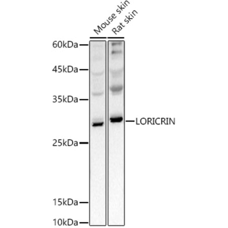 Western Blot - Anti-Loricrin Antibody (A307894) - Antibodies.com