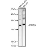 Western Blot - Anti-Loricrin Antibody (A307894) - Antibodies.com