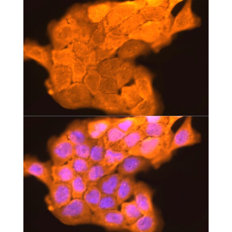 Immunofluorescence - Anti-Loricrin Antibody (A307894) - Antibodies.com