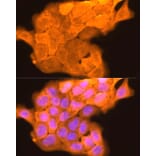 Immunofluorescence - Anti-Loricrin Antibody (A307894) - Antibodies.com