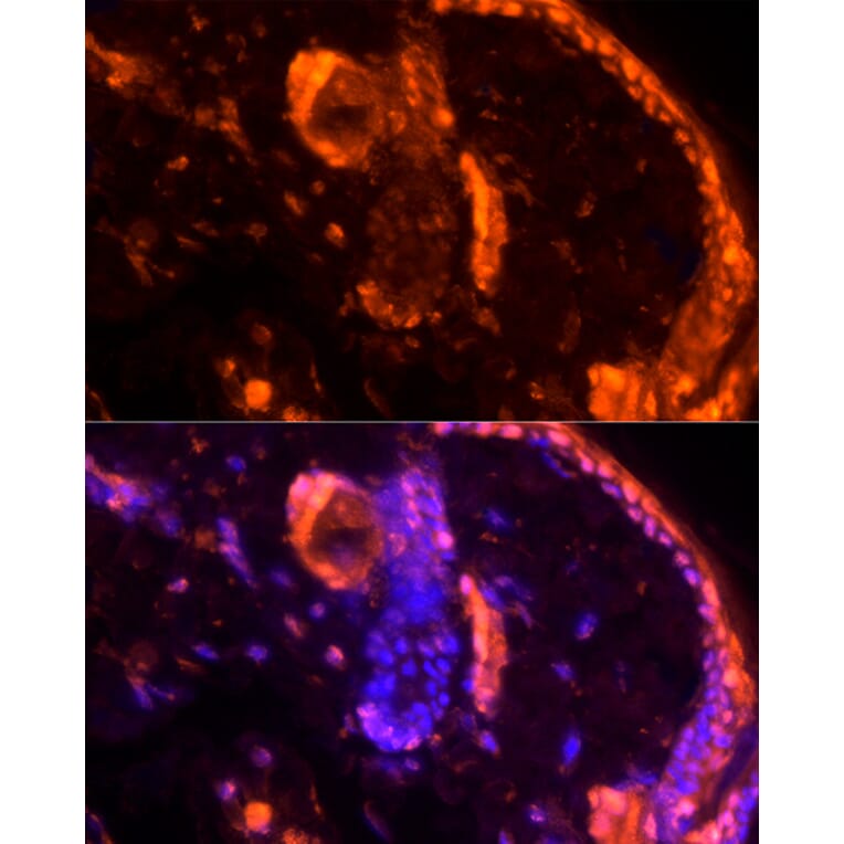 Immunofluorescence - Anti-Loricrin Antibody (A307894) - Antibodies.com
