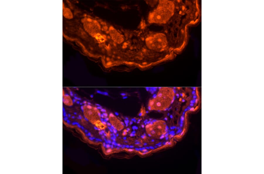 Immunofluorescence - Anti-Loricrin Antibody (A307894) - Antibodies.com