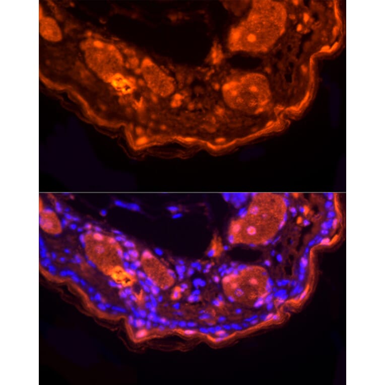 Immunofluorescence - Anti-Loricrin Antibody (A307894) - Antibodies.com