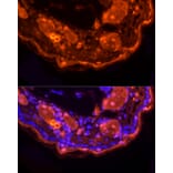 Immunofluorescence - Anti-Loricrin Antibody (A307894) - Antibodies.com