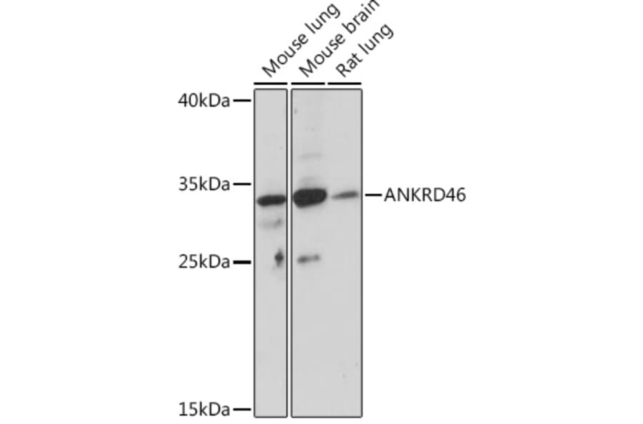 Western Blot - Anti-ANKRD46 Antibody (A307895) - Antibodies.com