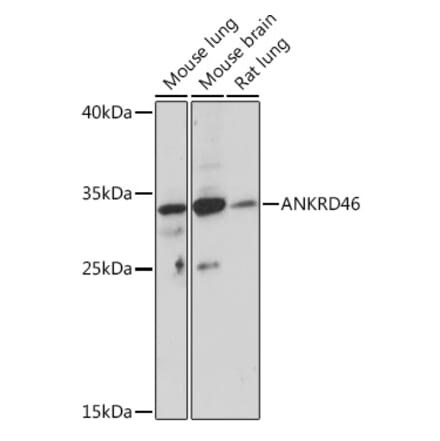 Western Blot - Anti-ANKRD46 Antibody (A307895) - Antibodies.com