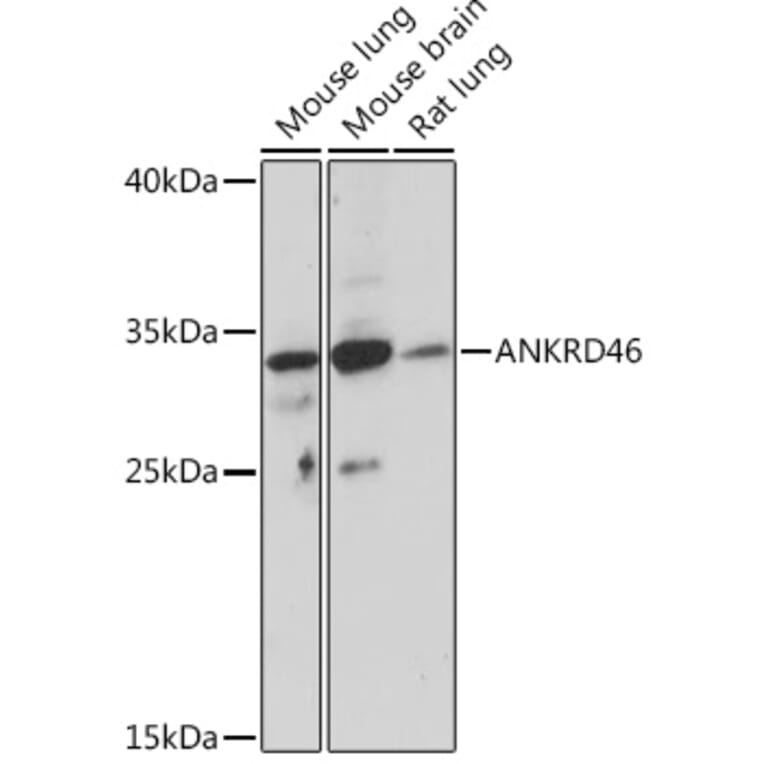 Western Blot - Anti-ANKRD46 Antibody (A307895) - Antibodies.com