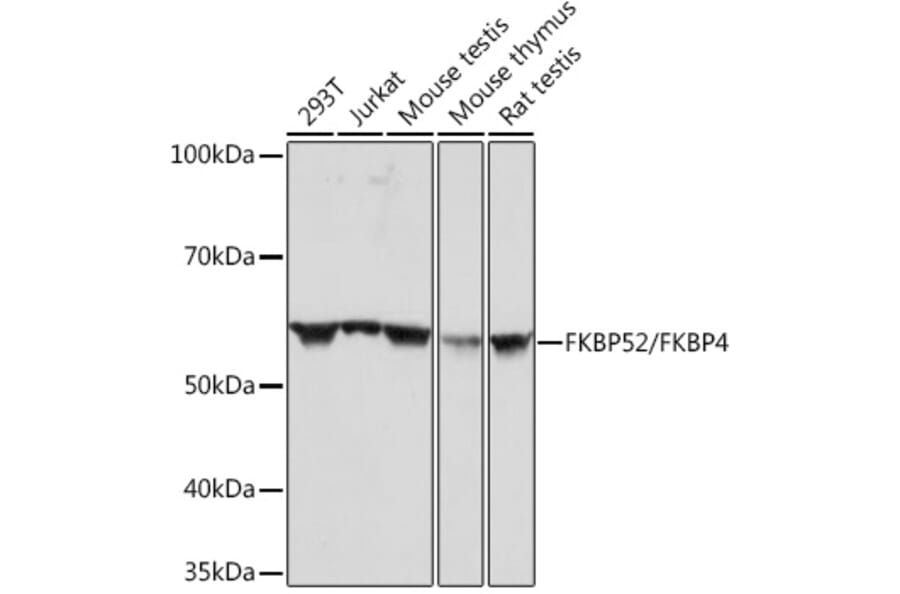 Western Blot - Anti-FKBP52 Antibody [ARC0977] (A307896) - Antibodies.com