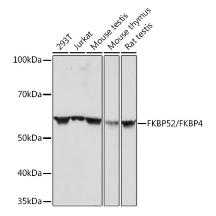 Western Blot - Anti-FKBP52 Antibody [ARC0977] (A307896) - Antibodies.com