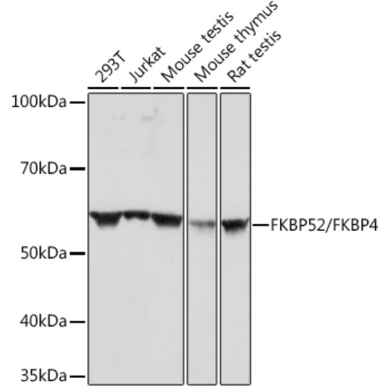 Western Blot - Anti-FKBP52 Antibody [ARC0977] (A307896) - Antibodies.com