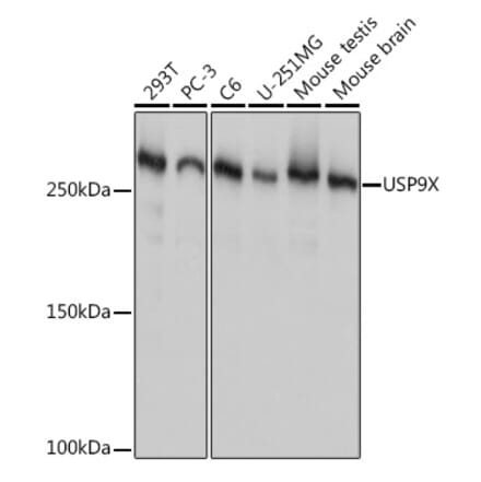 Western Blot - Anti-USP9x Antibody [ARC1748] (A307898) - Antibodies.com