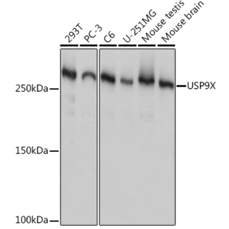 Western Blot - Anti-USP9x Antibody [ARC1748] (A307898) - Antibodies.com